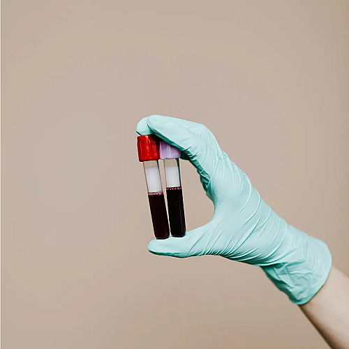 Marek Health vs. Function: The Question of Ongoing Optimization