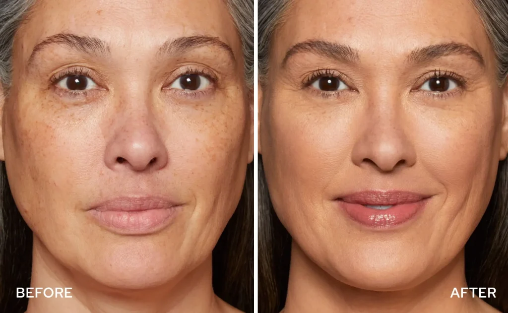 before after2 1024x631