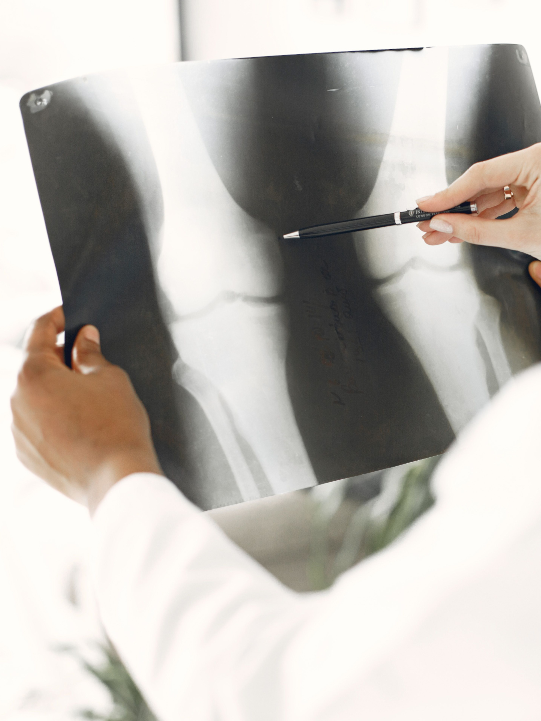 Person holding and examining a knee X-ray image